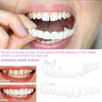 Силиконовое отбеливание зубов, покрытие для зубов, брекеты, Имитация зубных протезов, верхние зубы, нижние зубы, набор с коробкой, идеальная улыбка, 2 шт./компл.