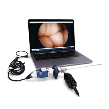 Высококачественная медицинская портативная USB-камера HD ent endoscope digital video endoscope